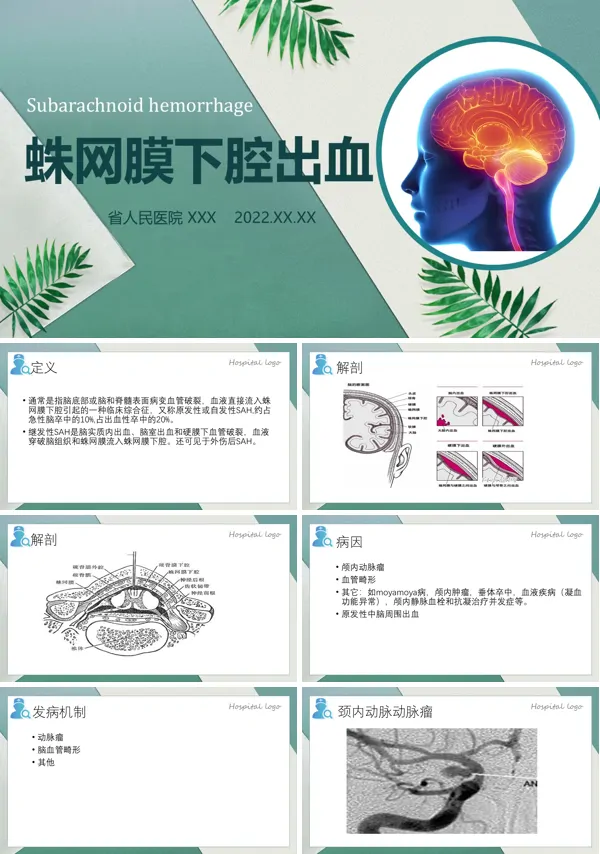蛛网膜下腔出血PPT医疗课件
