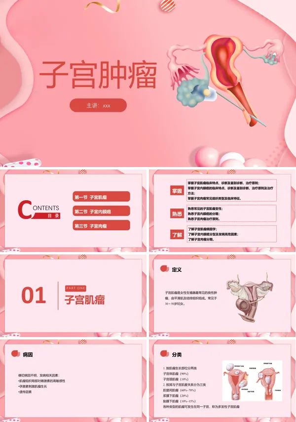 子宫肿瘤妇产科学课件ppt下载模板