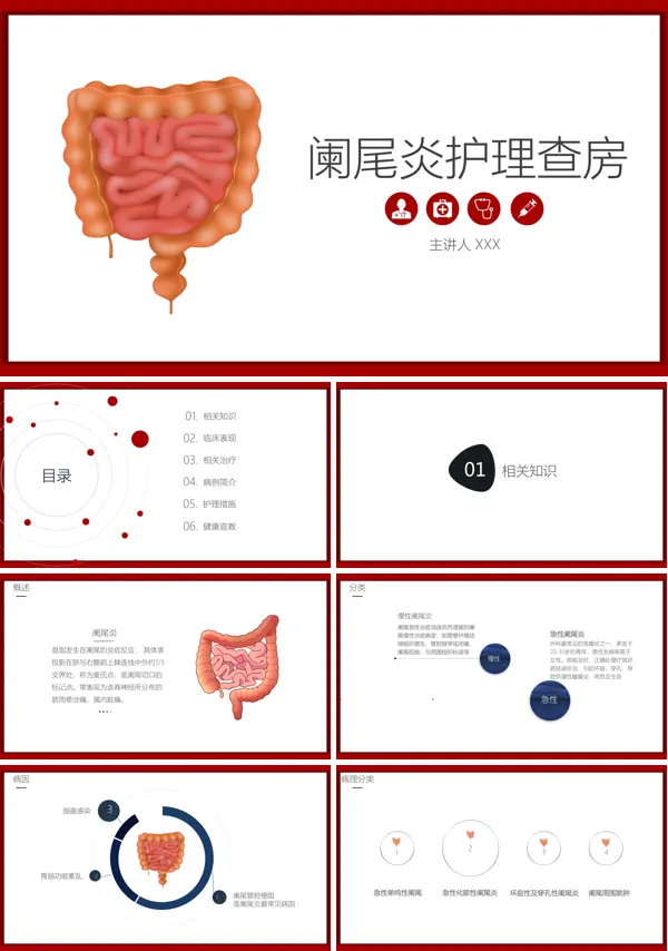外科学阑尾炎PPT课件