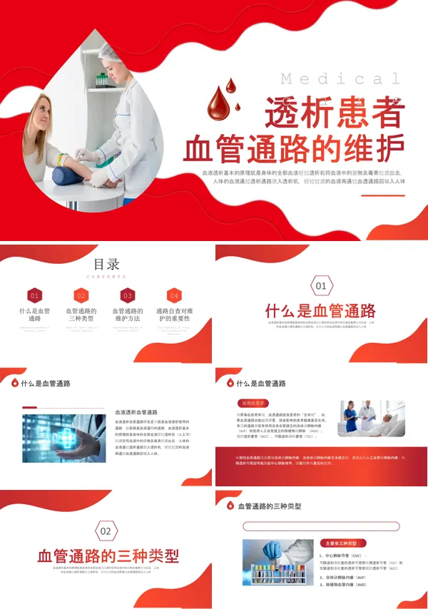 血液透析血管通路的护理ppt模板