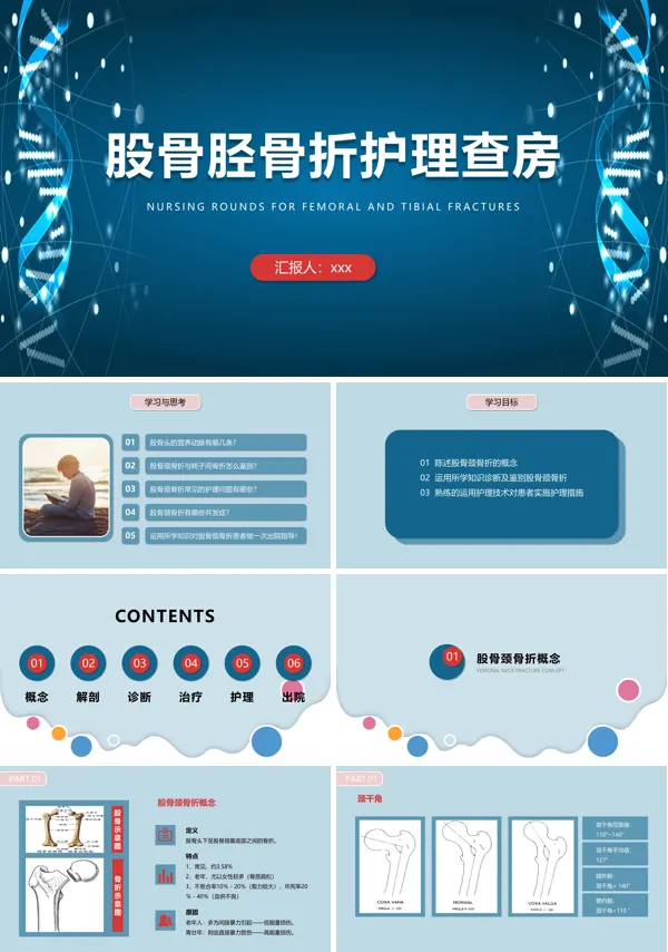 股骨颈骨折护理查房ppt模板含讲稿