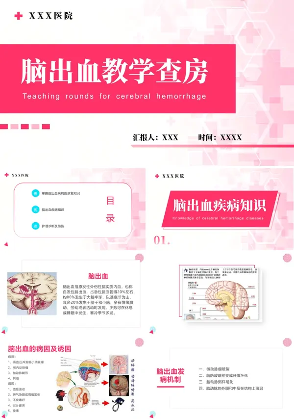 脑出血教学查房主题讲座课件PPT含讲稿