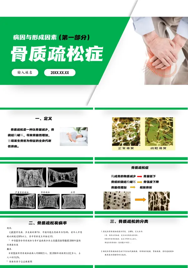 骨质疏松症护理ppt