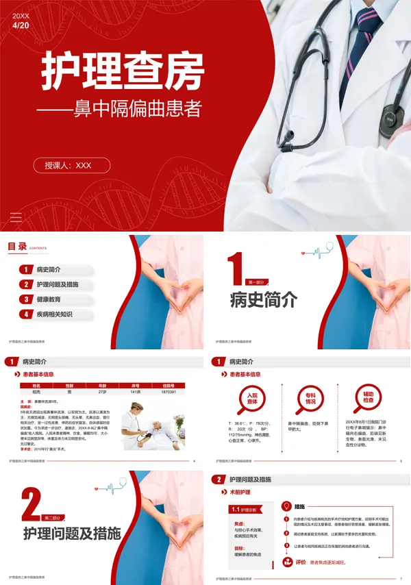 鼻中隔偏曲患者的护理ppt课件