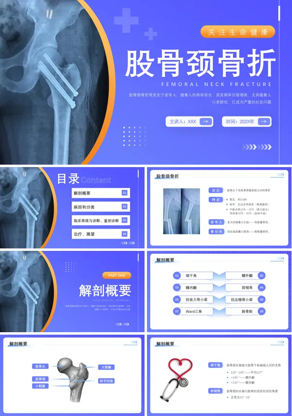 股骨颈骨医护人员培训PPT