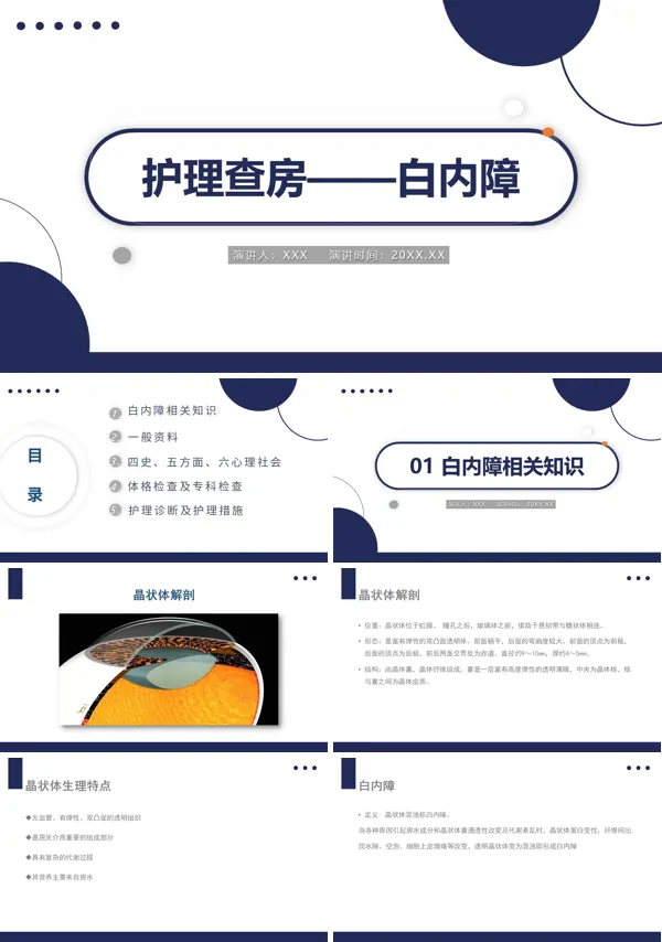 白内障护理教学查房PPT课件