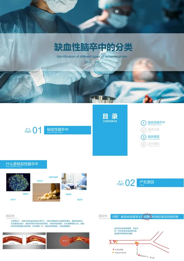 缺血性脑卒中的识别与处理PPT模板