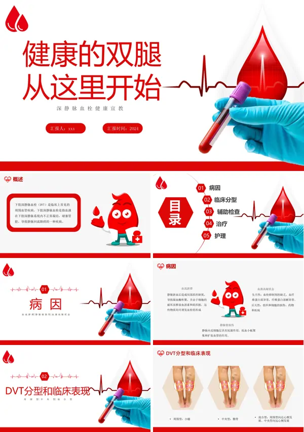 深静脉血栓健康宣教健康的双腿从这里开始PPT模板