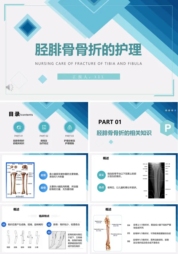 胫腓骨骨折护理PPT课件