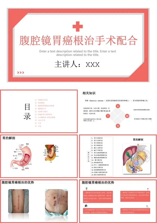 腹腔镜胃癌根治术的手术配合PPT课件