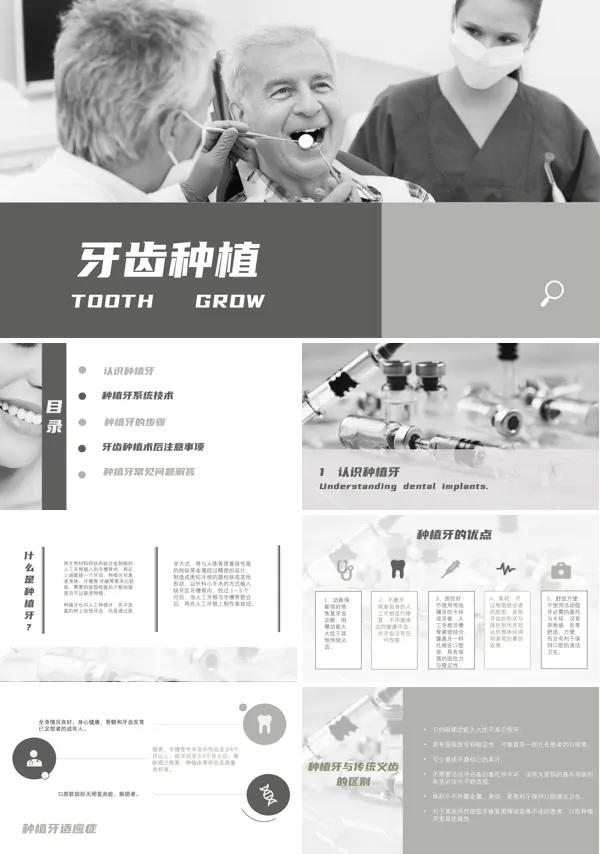 种植牙ppt含讲稿