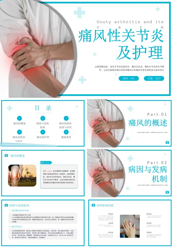 痛风性关节炎的护理ppt课件