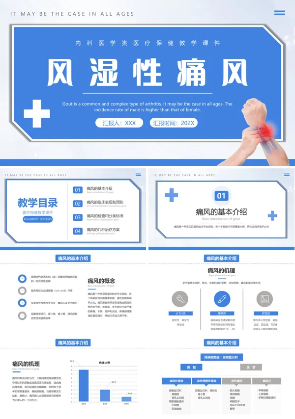 风湿性关节炎痛风ppt课件