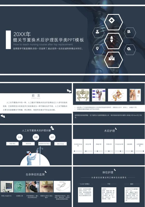 髋关节置换术后护理PPT下载模板