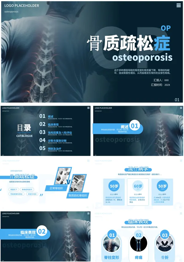 骨质疏松的健康教育PPT课件