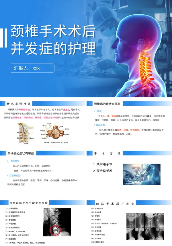 颈椎手术术后并发症的护理PPT模板含讲稿