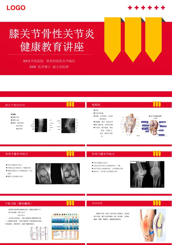 膝关节骨性关节炎健康教育讲座PPT