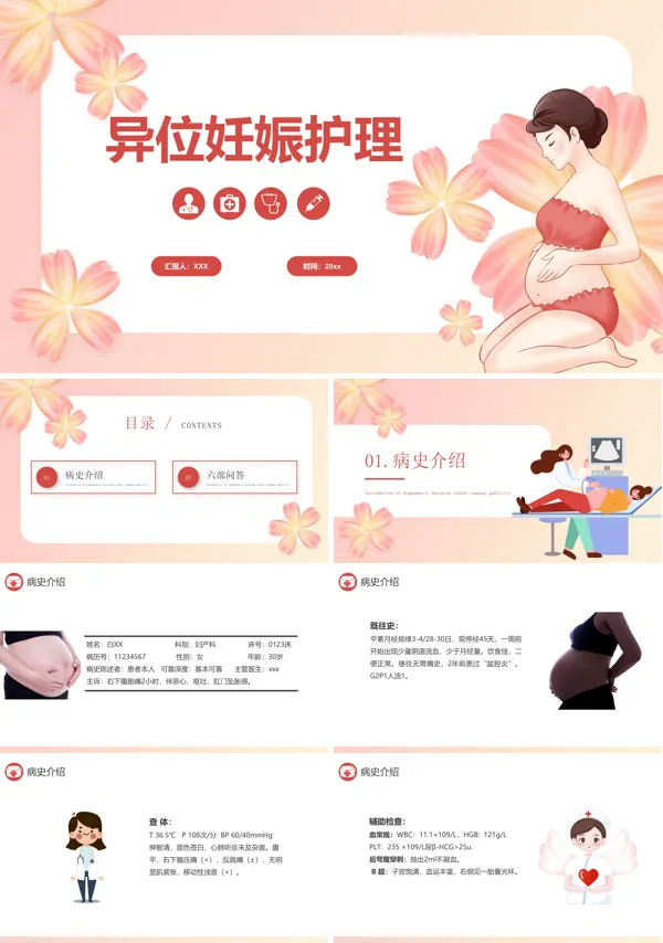 异位妊娠护理查房PPT课件