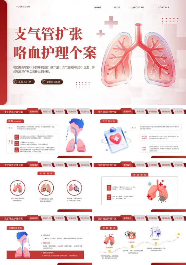 支气管扩张并咯血的个案护理ppt课件含讲稿