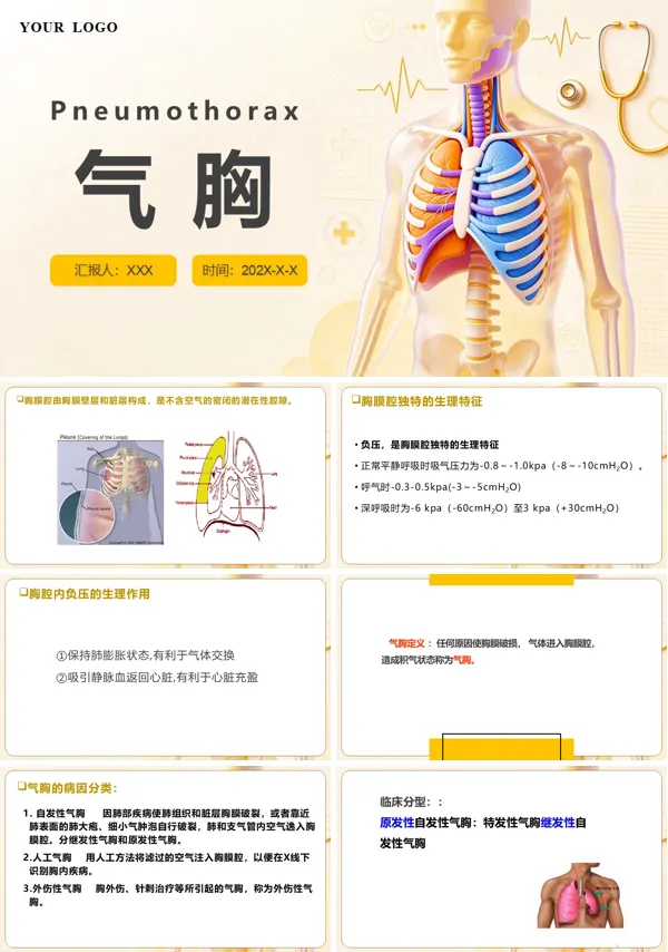 气胸医疗护理查房培训课件PPT含讲稿
