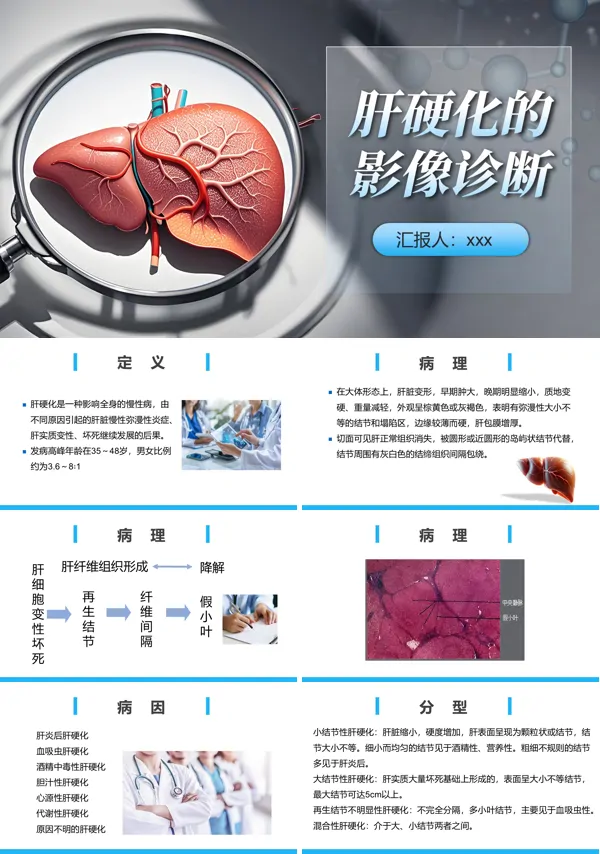 肝硬化的影像诊断PPT模板含讲稿