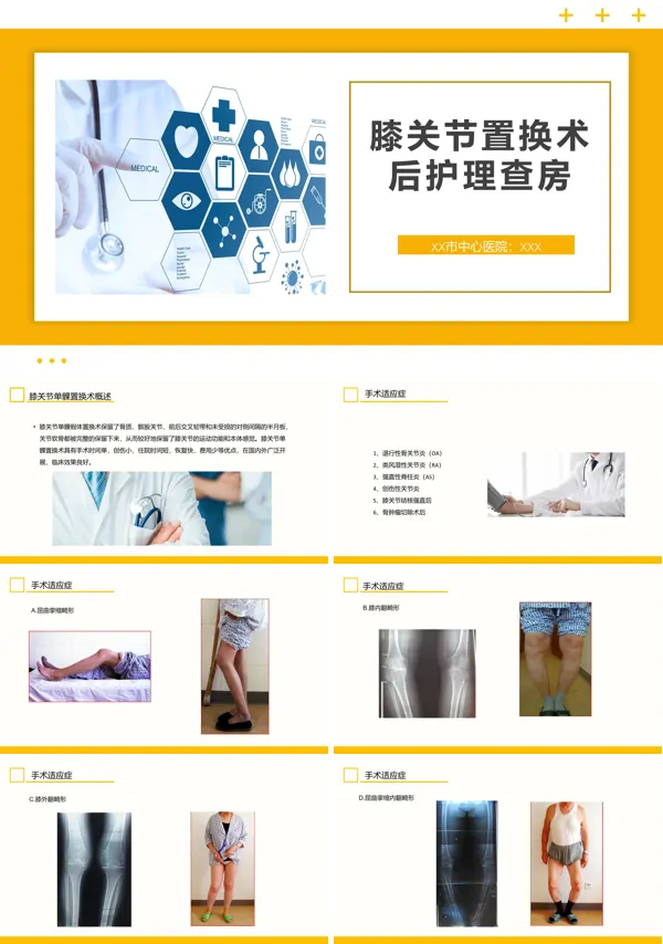 膝关节置换术后护理查房膝关节炎护理查房PPT课件