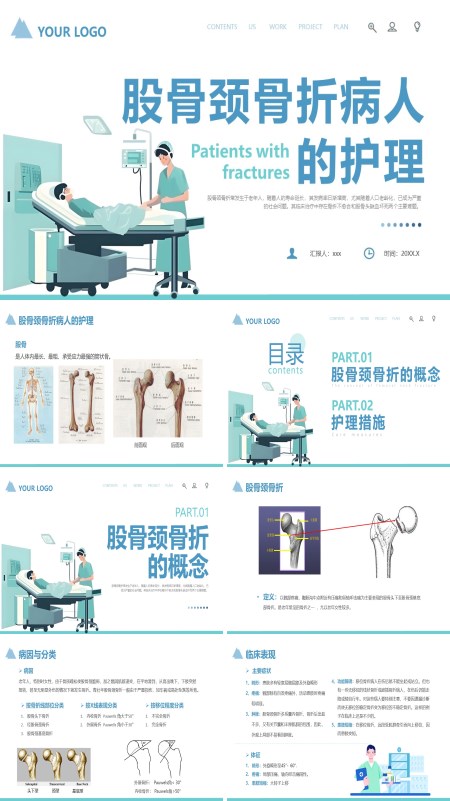 股骨颈骨折护理教学查房ppt模板