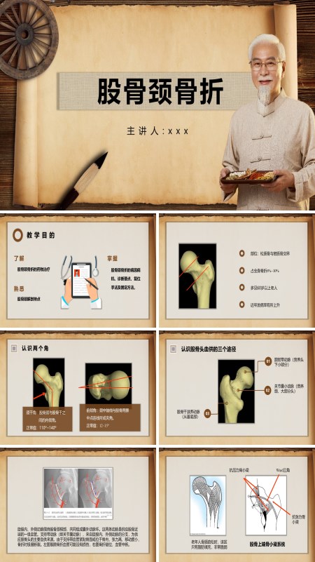 股骨颈骨折PPT模板含讲稿