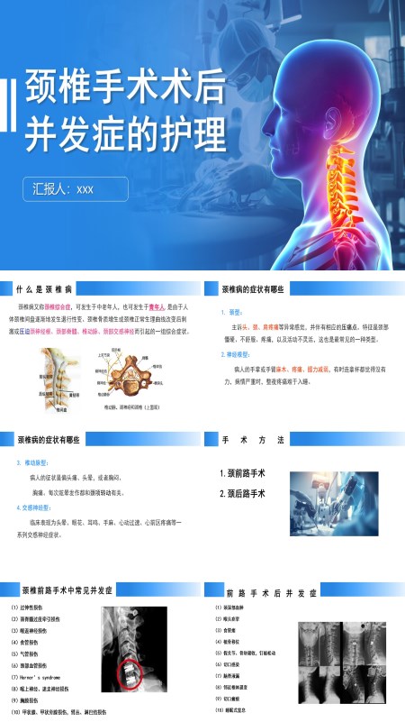 颈椎手术术后并发症的护理PPT模板含讲稿