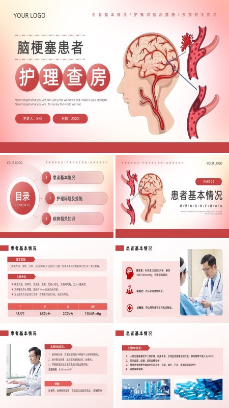 脑梗患者护理查房PPT模板含讲稿