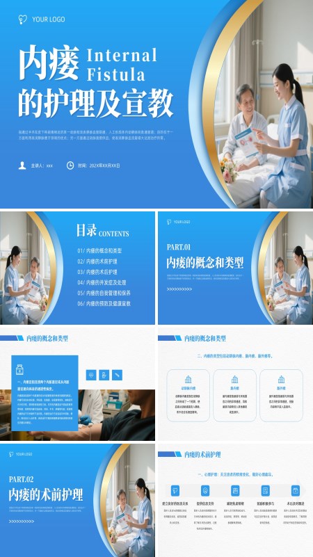 内瘘的护理知识PPT模板含讲稿
