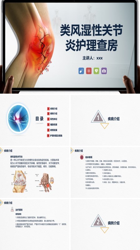 类风湿性关节炎护理查房PPT模板含讲稿