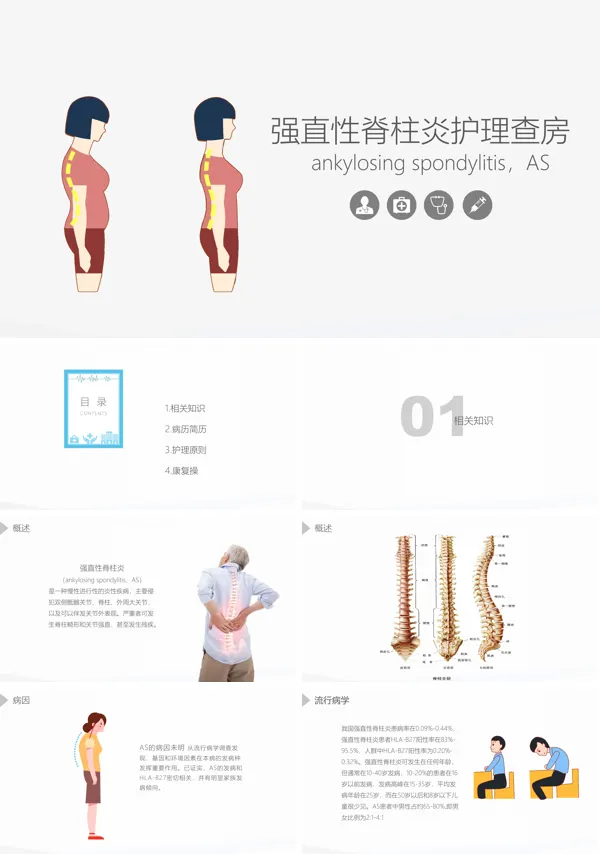 强直性脊柱炎护理查房PPT课件