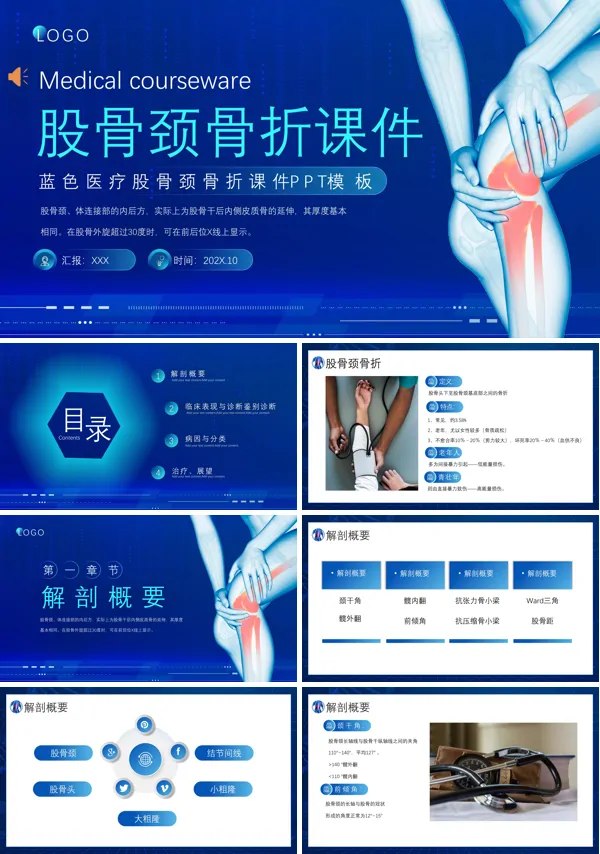股骨颈骨折学习ppt课件