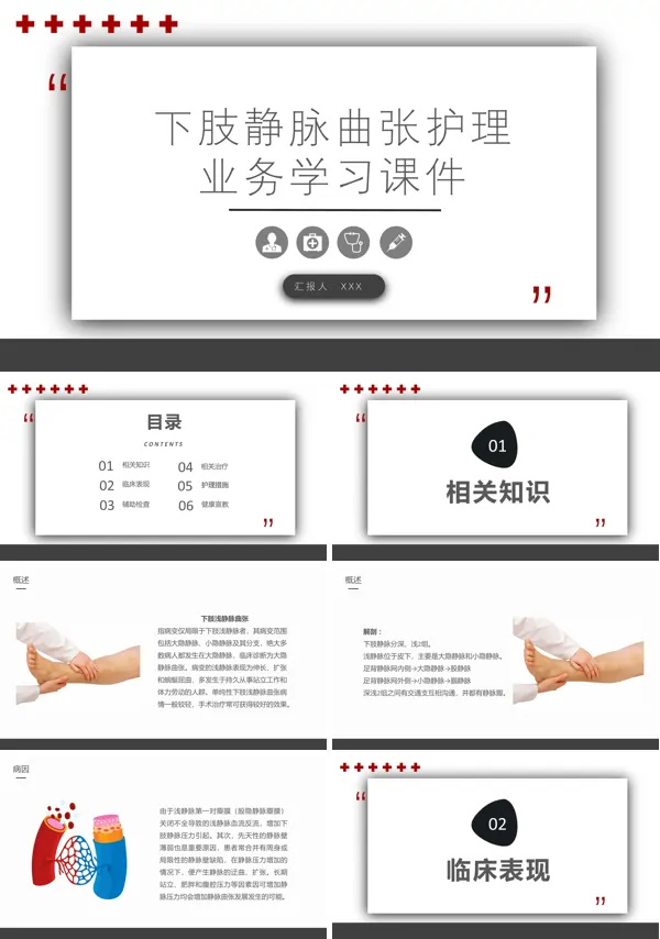 下肢静脉曲张护理查房PPT课件