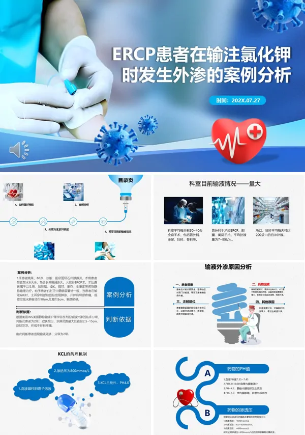 静脉输液氯化钾外渗案例PPT模板含讲稿