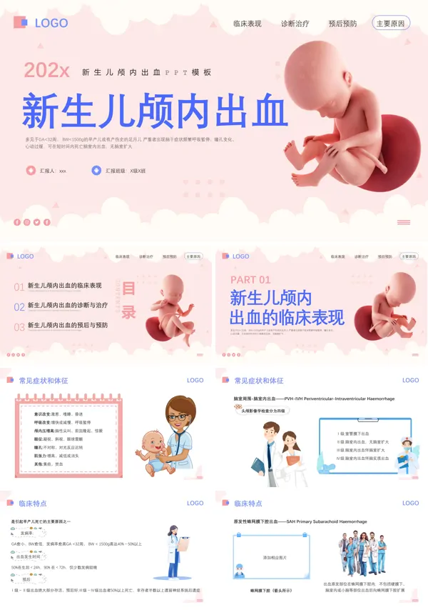 新生儿颅内出血PPT