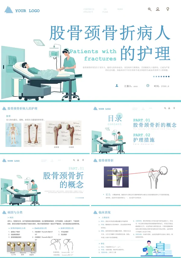 股骨颈骨折护理教学查房ppt模板