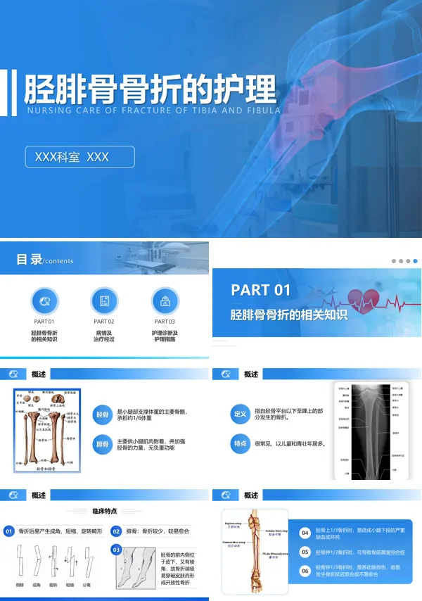胫腓骨骨折的护理查房ppt课件