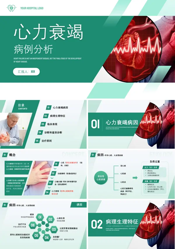 心力衰竭病例分析PPT下载模板