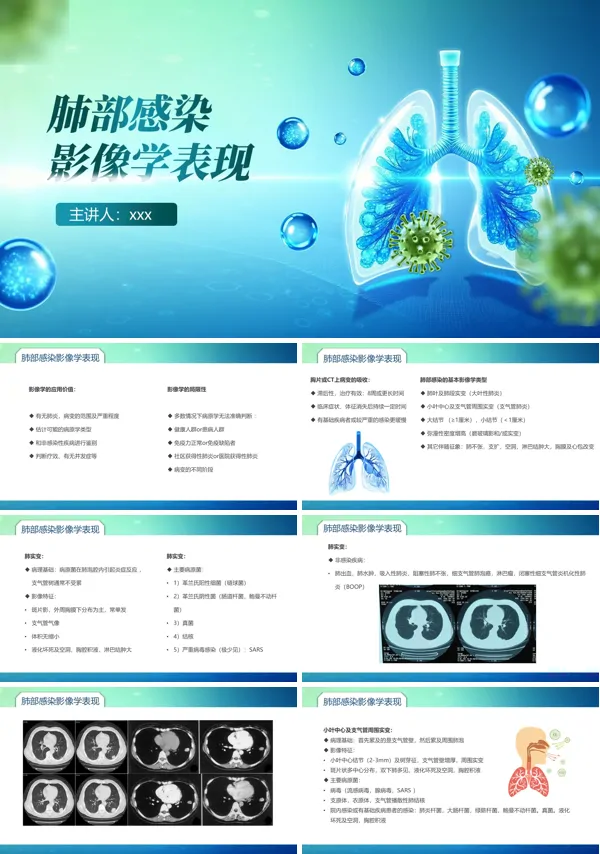 肺部感染影像学表现PPT模板含讲稿
