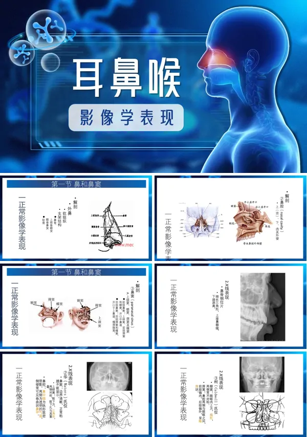 耳鼻喉在影像学的表现PPT模板含讲稿