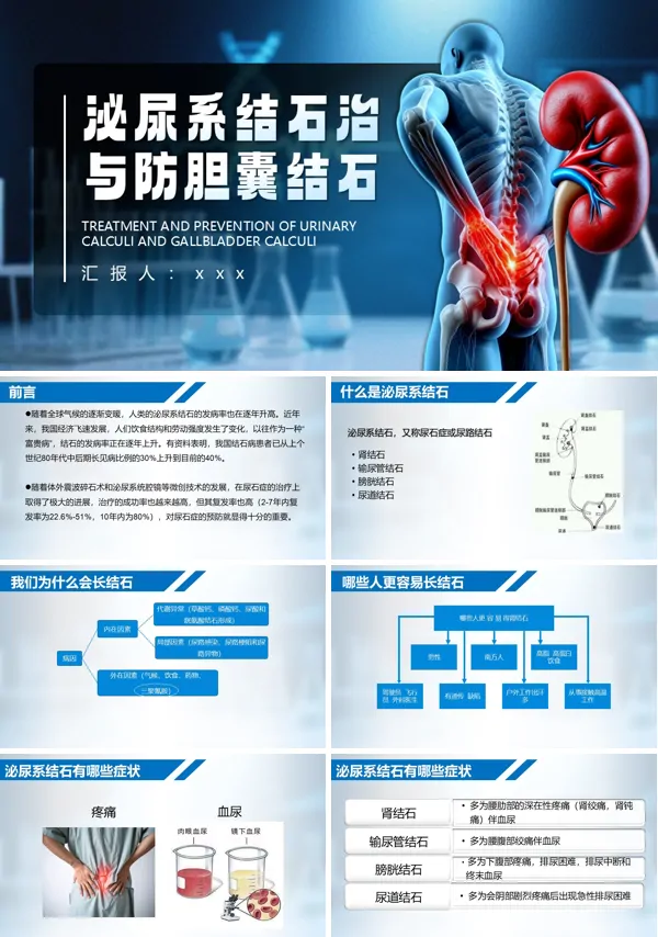 泌尿结石治与防胆囊结石护理查房PPT模板含讲稿
