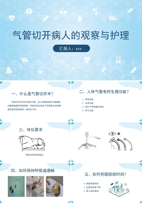 气管切开病人的观察与护理PPT下载模板