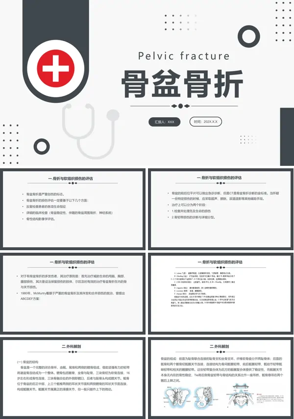 骨盆骨折术后的护理查房ppt