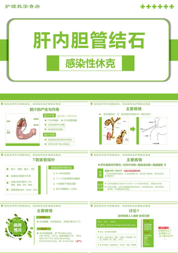 感染性休克肝胆内结石护理教学查房PPT模版