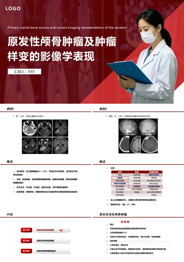 颅骨肿瘤影像学表现ppt课件含讲稿