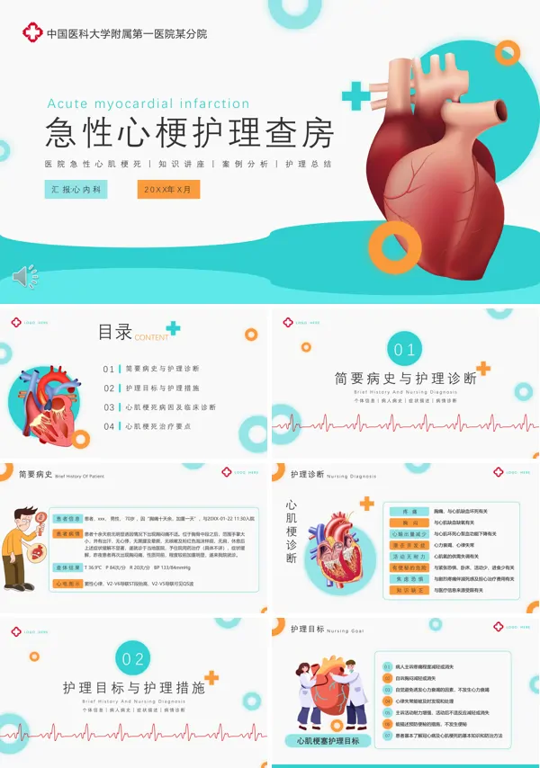 急性心梗护理查房PPT