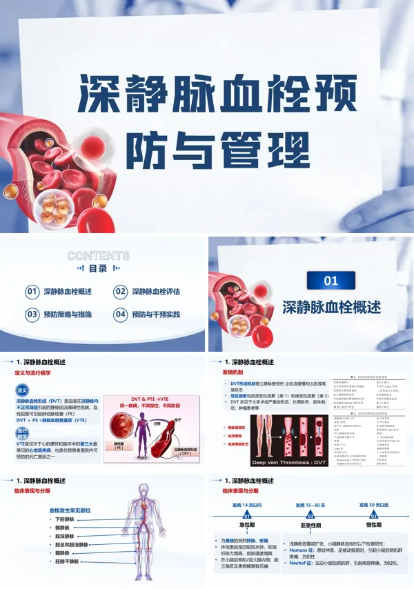深静脉血栓预防与管理医疗护理ppt模板含讲稿