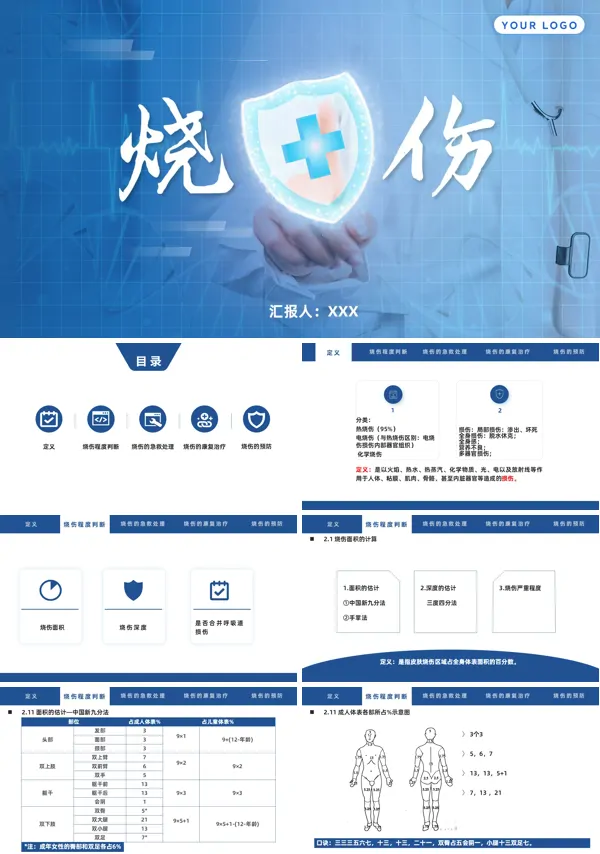 烧伤患者护理查房教学PPT课件含讲稿